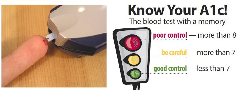 Importance of monitoring blood sugar